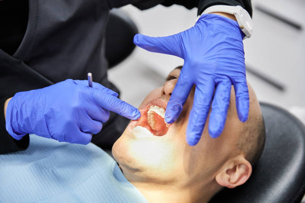 Best Chipped Tooth Repair Near Me  in Sealy, TX